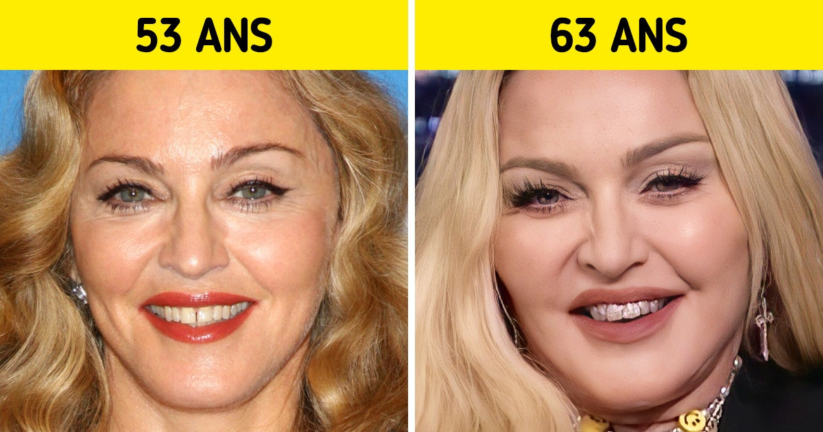 15 Visages de stars qui changent avec le temps sans qu’on ne le remarque