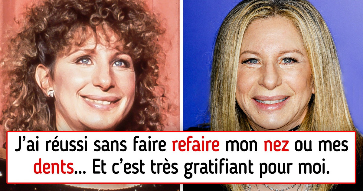 8 Stars qui ont dit non à la chirurgie esthétique et ont prouvé qu’on n’a pas besoin d’être parfaite pour être heureuse