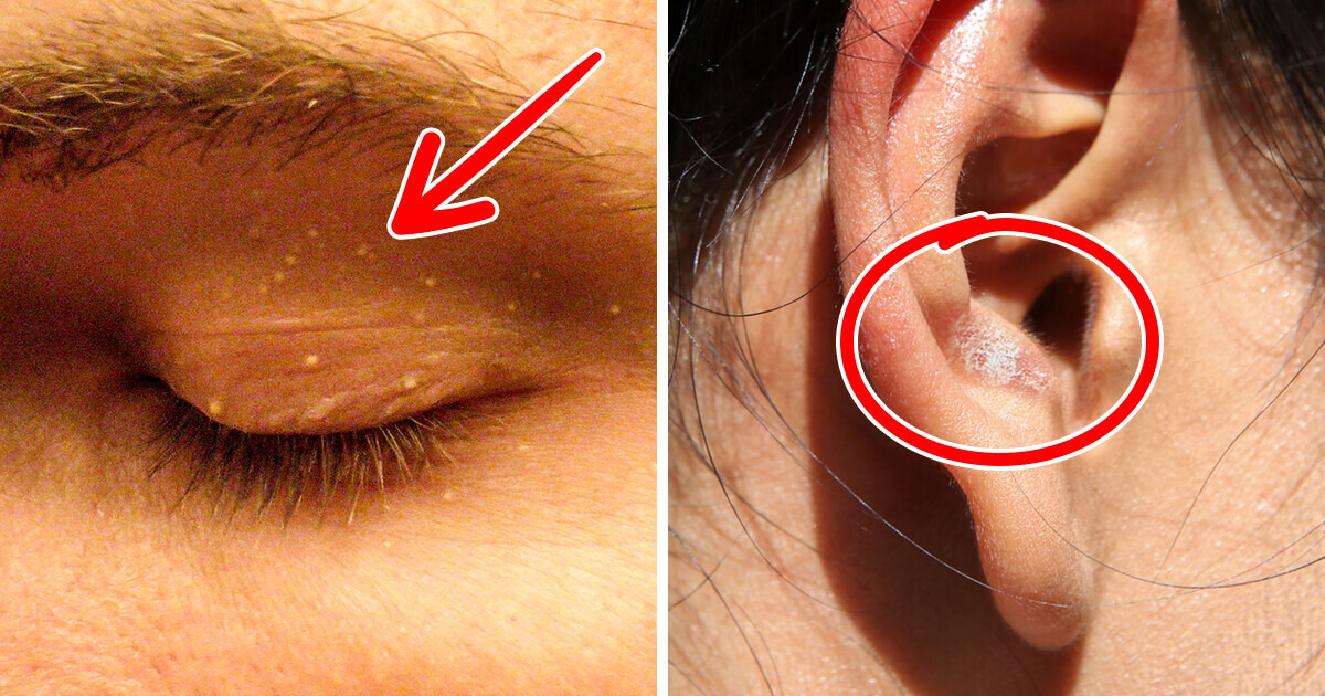 6 Signes subtils sur le visage qui peuvent révéler des problèmes de santé graves 6 Signes subtils sur le visage qui peuvent révéler des problèmes de santé graves