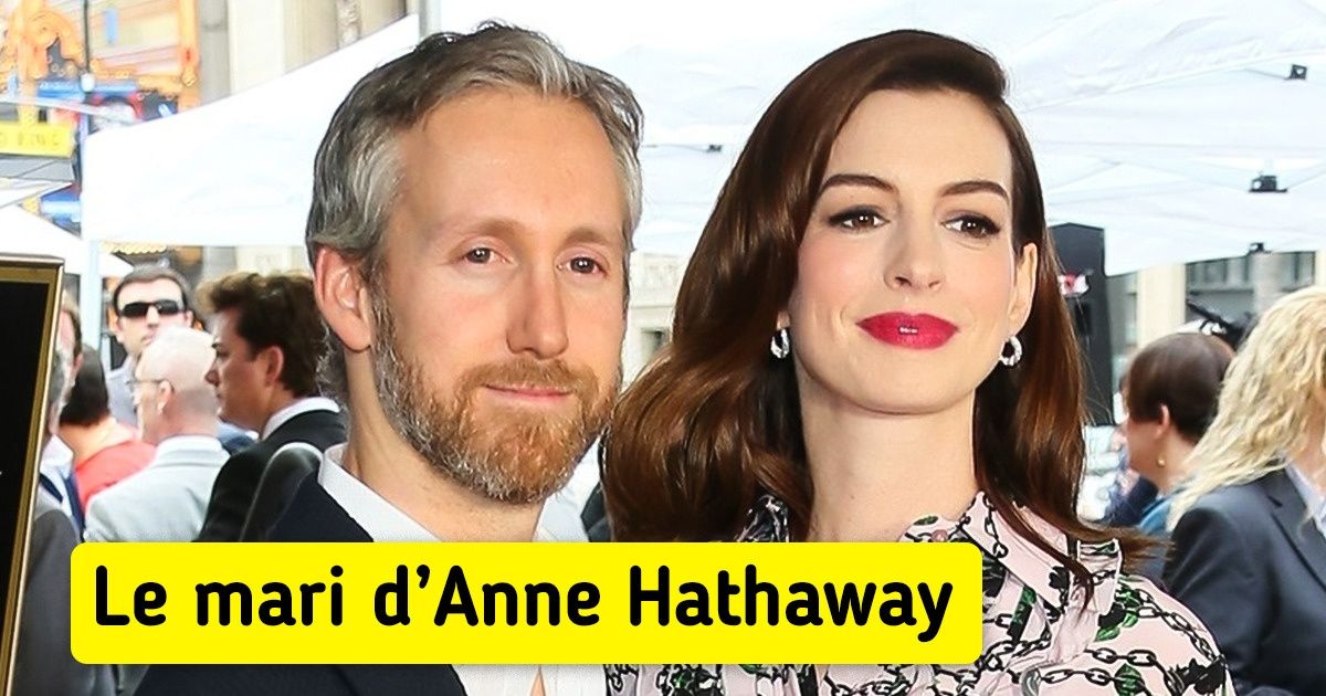 Voici à quoi ressemblent les compagnons de certaines stars d’Hollywood au physique atypique