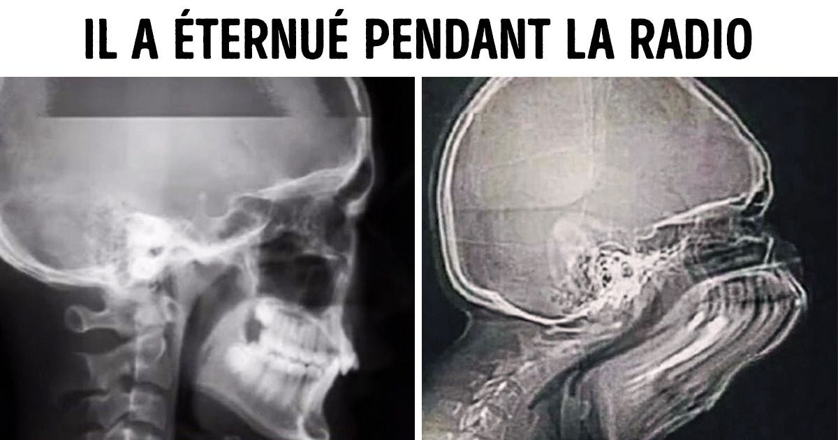19 Preuves que des choses familières peuvent te surprendre