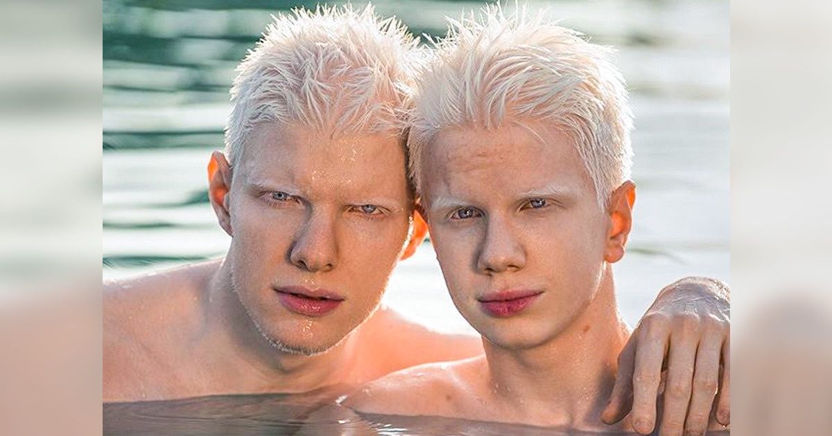 18 Personnes dont la beauté unique va vous fasciner 18 Personnes dont la beauté unique va vous fasciner
