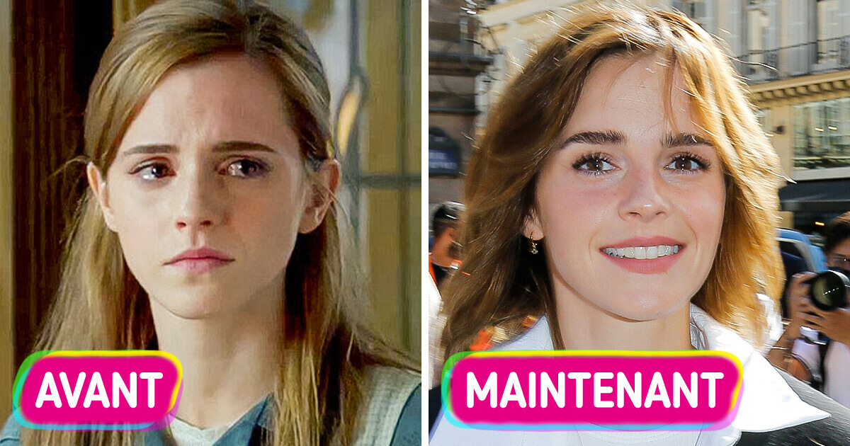 Emma Watson a révélé pourquoi elle a dû arrêter son métier d’actrice