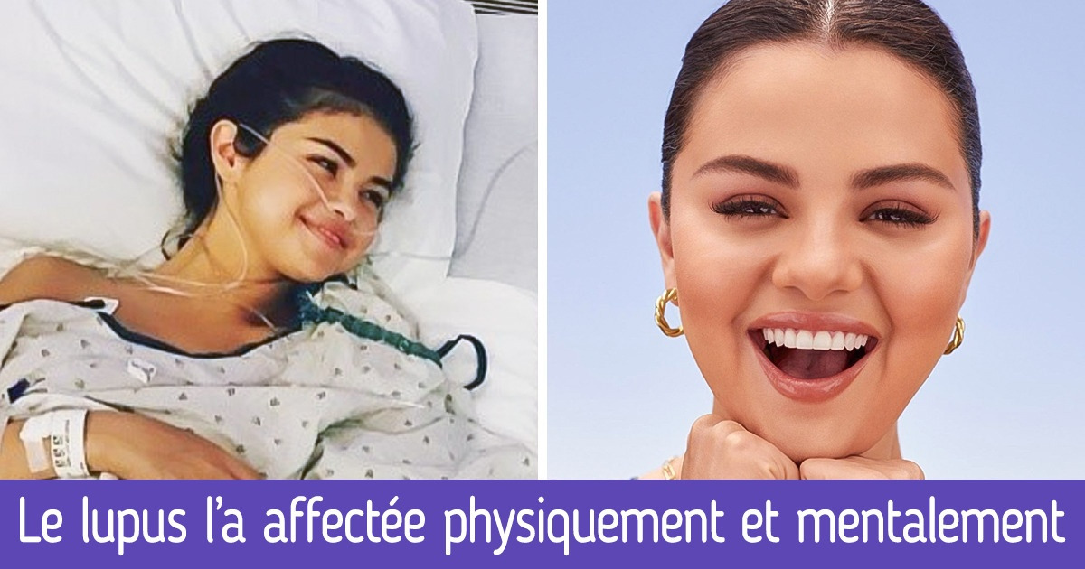 Histoire inspirante de Selena Gomez : voici comment elle a réussi à faire face aux épreuves de la vie