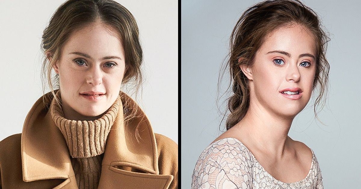 Un mannequin trisomique prouve que tu es le seul à pouvoir définir tes critères de beauté