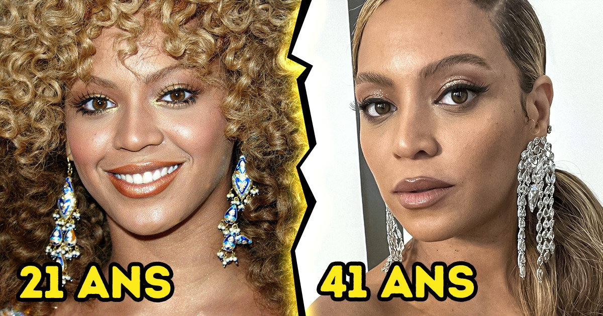 15+ Célébrités qui n’ont pas pris une seule ride en deux décennies