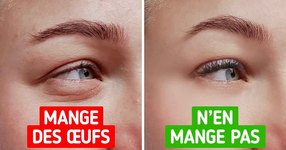 Découvre ce qui pourrait arriver si tu arrêtais complètement de manger des œufs