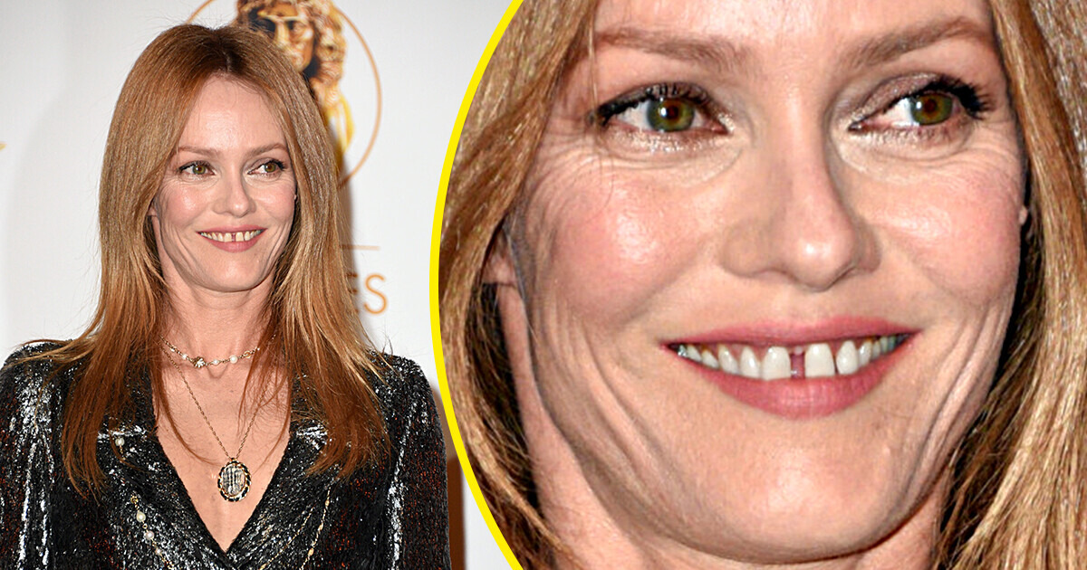 10 Célébrités qui se moquent royalement des standards de beauté