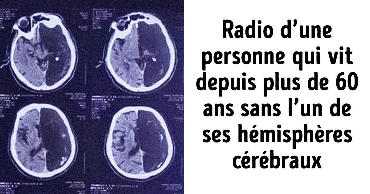20 Faits incompréhensibles qui pourraient changer l’idée que tu as de ton propre corps 20 Faits incompréhensibles qui pourraient changer l’idée que tu as de ton propre corps