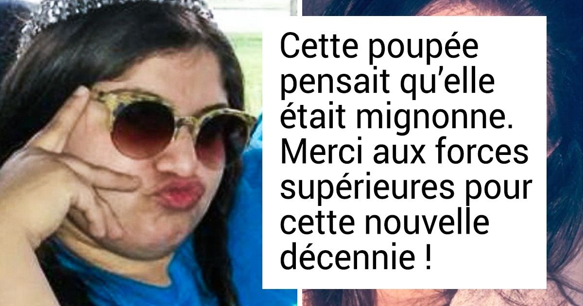 20+ Personnes qui étaient considérées comme de vilains petits canards, mais qui se sont incroyablement transformées