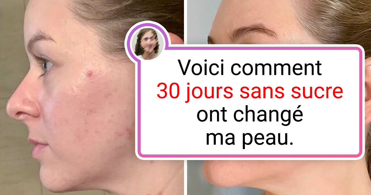 20+ Photos qui montrent clairement ce qu'est une grande différence