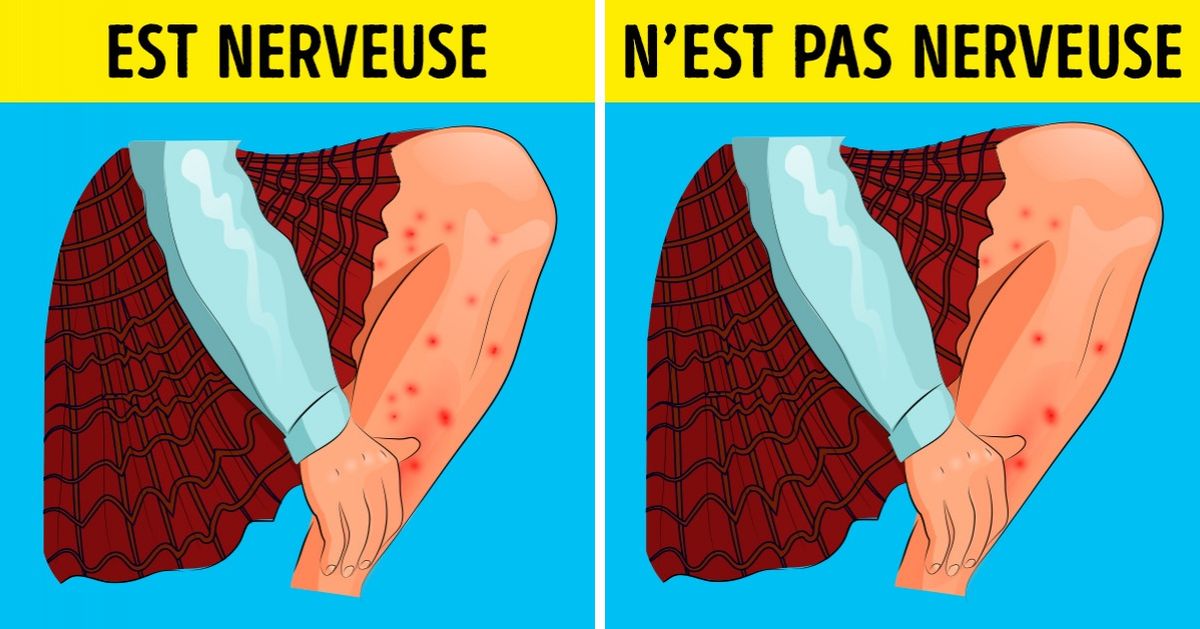 Les dermatologues ont expliqué pourquoi on doit traiter sa peau avec des émotions plutôt qu’avec d’autres remèdes