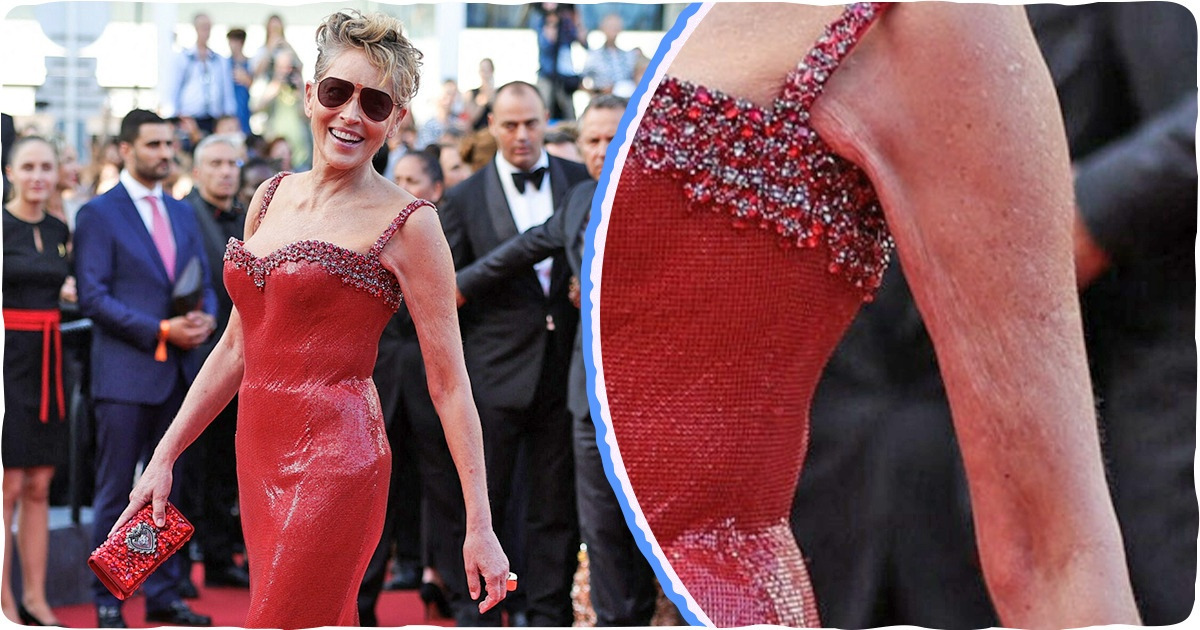 13 Célébrités qui assument de montrer leur corps naturel avec des imperfections