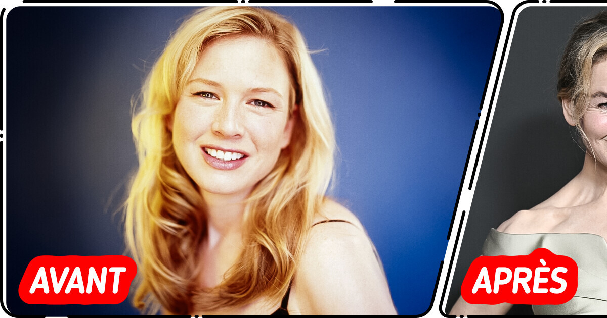 "Qu’est-ce qui ne va pas au niveau de ses lèvres ?" : Le nouveau look de Renée Zellweger inquiète ses fans "Qu’est-ce qui ne va pas au niveau de ses lèvres ?" : Le nouveau look de Renée Zellweger inquiète ses fans