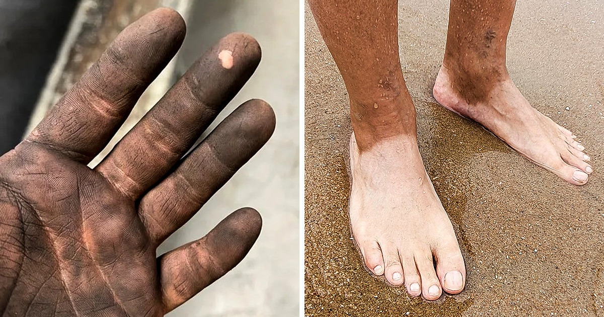 19 Comparaisons de photos qui n’ont pas à être commentées, tellement elles sont explicites