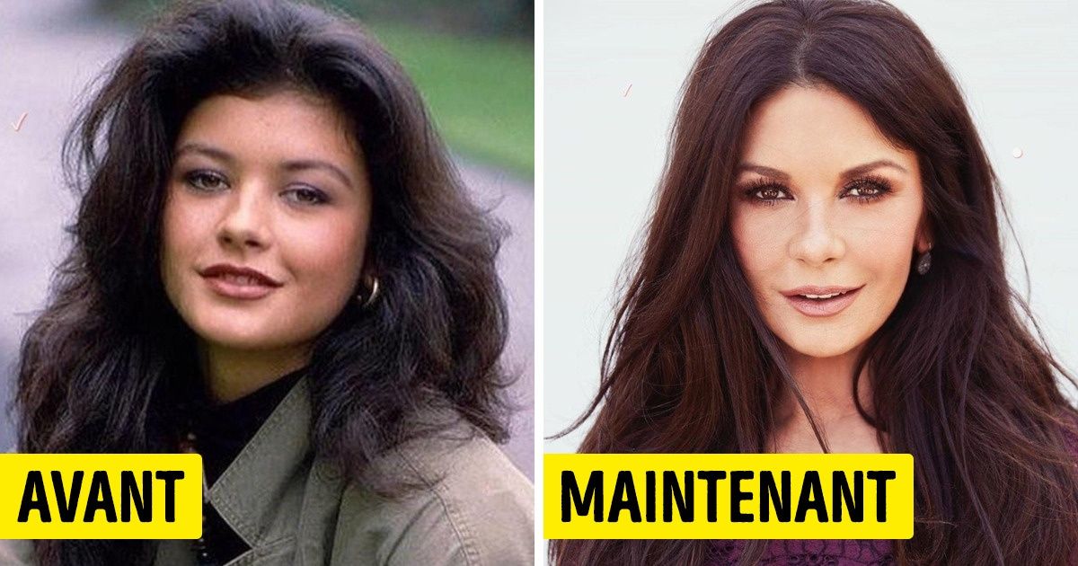 Regarde à quoi ressemblaient les célébrités avant d’avoir modifié leur apparence Regarde à quoi ressemblaient les célébrités avant d’avoir modifié leur apparence