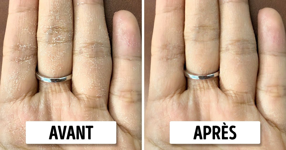 5 Rituels de soin pour avoir les mains bien hydratées 5 Rituels de soin pour avoir les mains bien hydratées