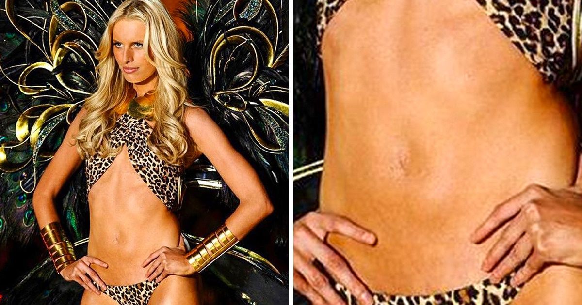 14 célébrités qui ont accepté leurs défauts et ont fait preuve d’amour envers leur corps