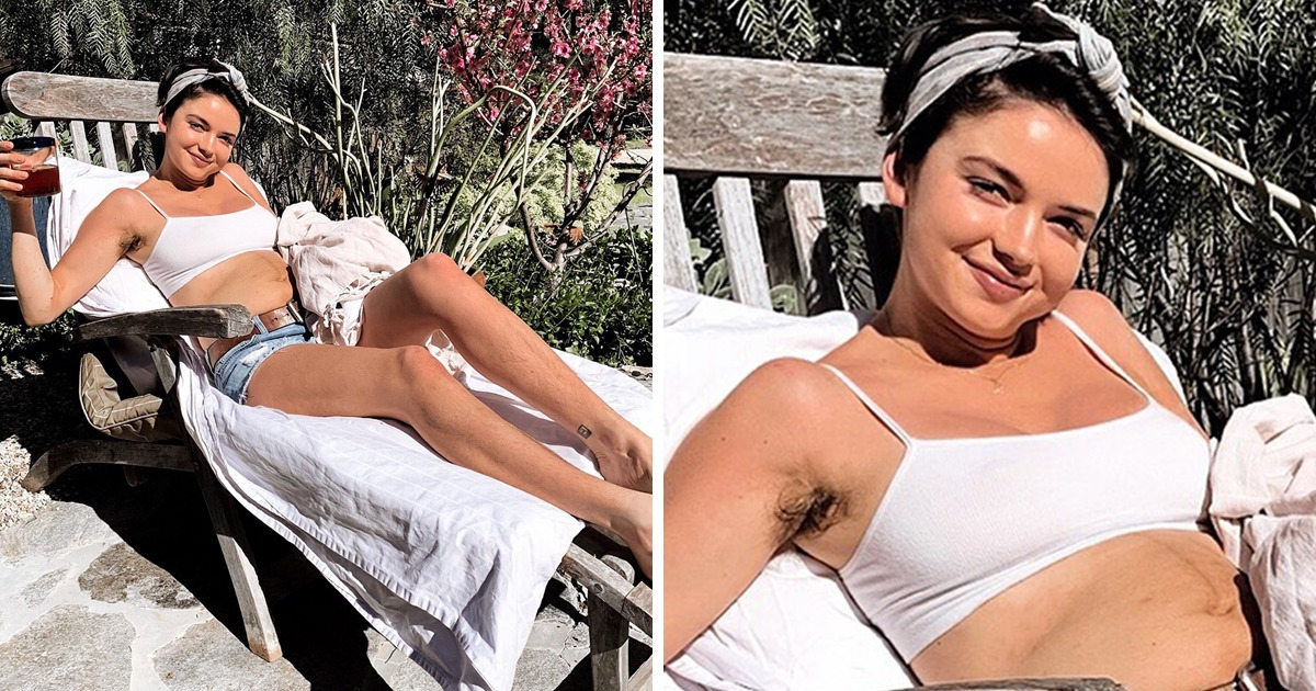 13 Stars qui nous rappellent que la beauté n’est pas synonyme de perfection