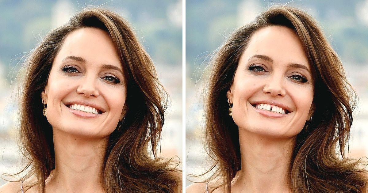 15 Photos qui montrent à quel point les dents peuvent changer ton visage