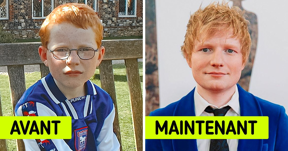 14 Photos de stars à la beauté tout sauf classique, enfants et maintenant