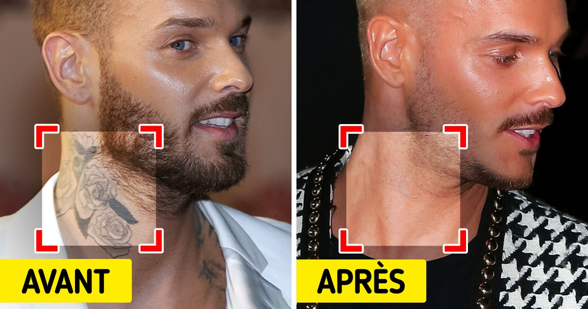 10 Stars françaises et internationales qui ont affiché fièrement leurs tatouages et ont regretté leur choix