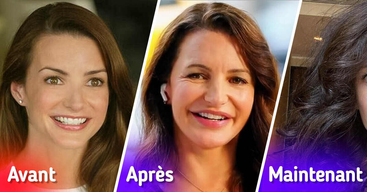 Kristin Davis, 59 ans, a dissous des produits de comblement sur le visage, laissant les gens pantois Kristin Davis, 59 ans, a dissous des produits de comblement sur le visage, laissant les gens pantois