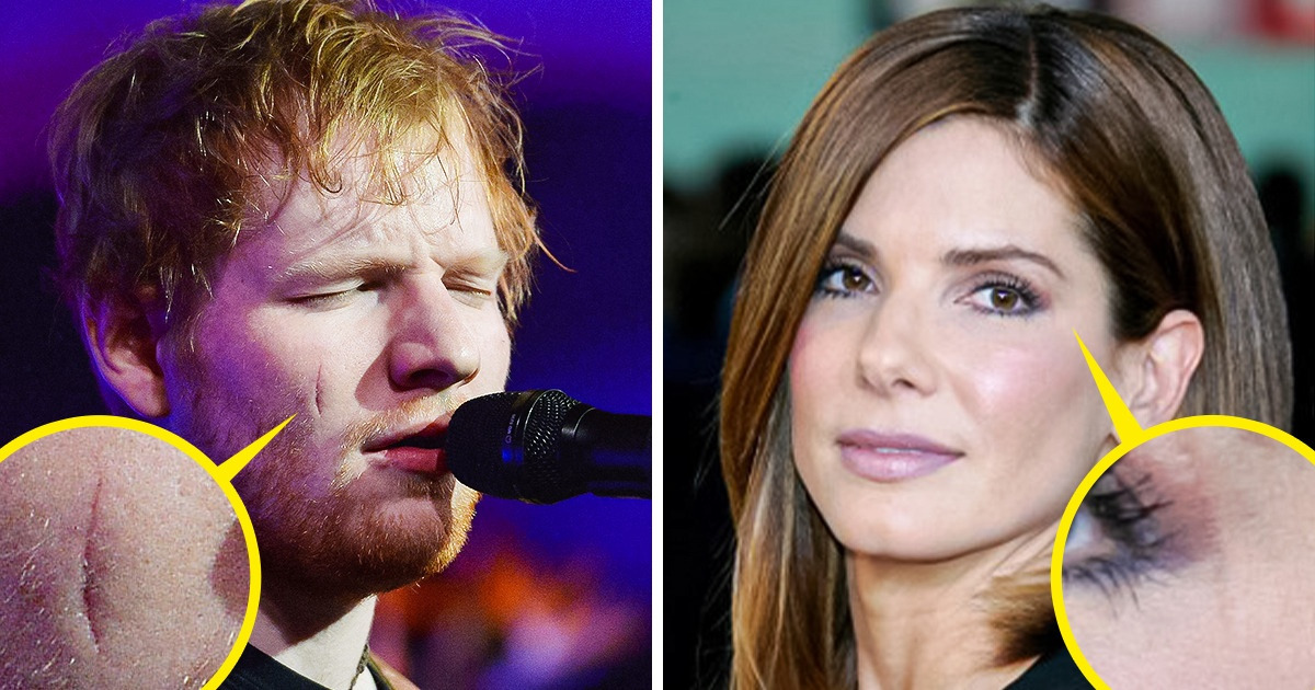 7 Célébrités qui embrassent leurs caractéristiques uniques 7 Célébrités qui embrassent leurs caractéristiques uniques