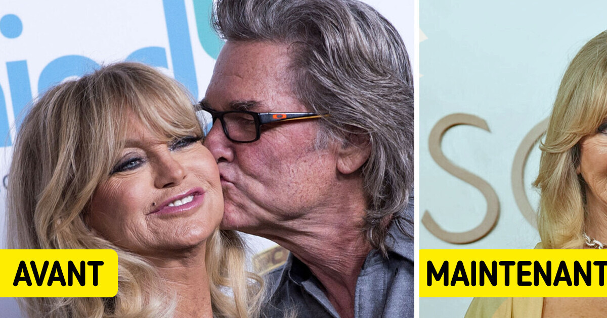 "Son visage : que s'est-il passé ?" Goldie Hawn révèle un souci de santé, mais les gens ne remarquent qu'une chose "Son visage : que s'est-il passé ?" Goldie Hawn révèle un souci de santé, mais les gens ne remarquent qu'une chose