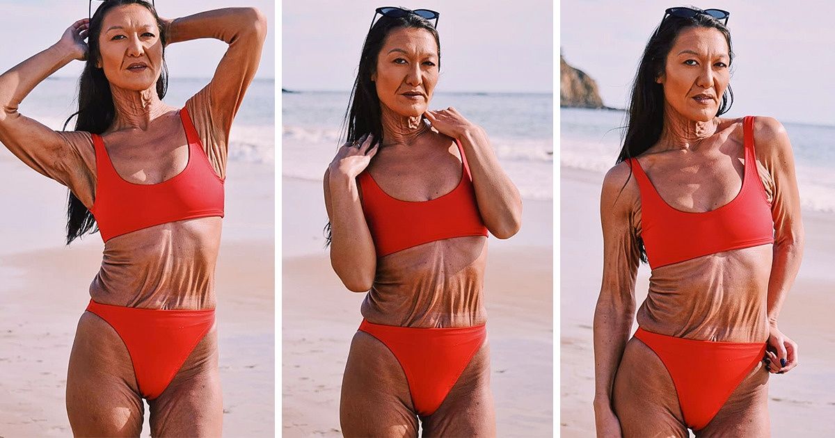 12 mannequins avec des “défauts” qui sont en train de changer le visage de la mode d’aujourd’hui 12 mannequins avec des “défauts” qui sont en train de changer le visage de la mode d’aujourd’hui