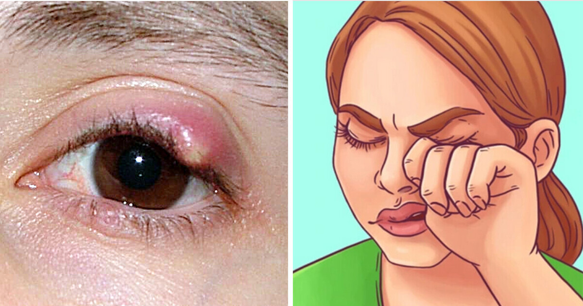 10 Signes oculaires qui peuvent révéler d'éventuels problèmes de santé 10 Signes oculaires qui peuvent révéler d'éventuels problèmes de santé