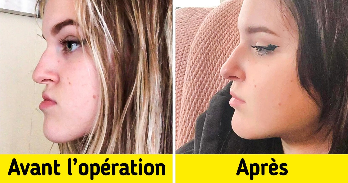 20 Images qui expliquent le mot “progrès” mieux que n’importe quelle définition