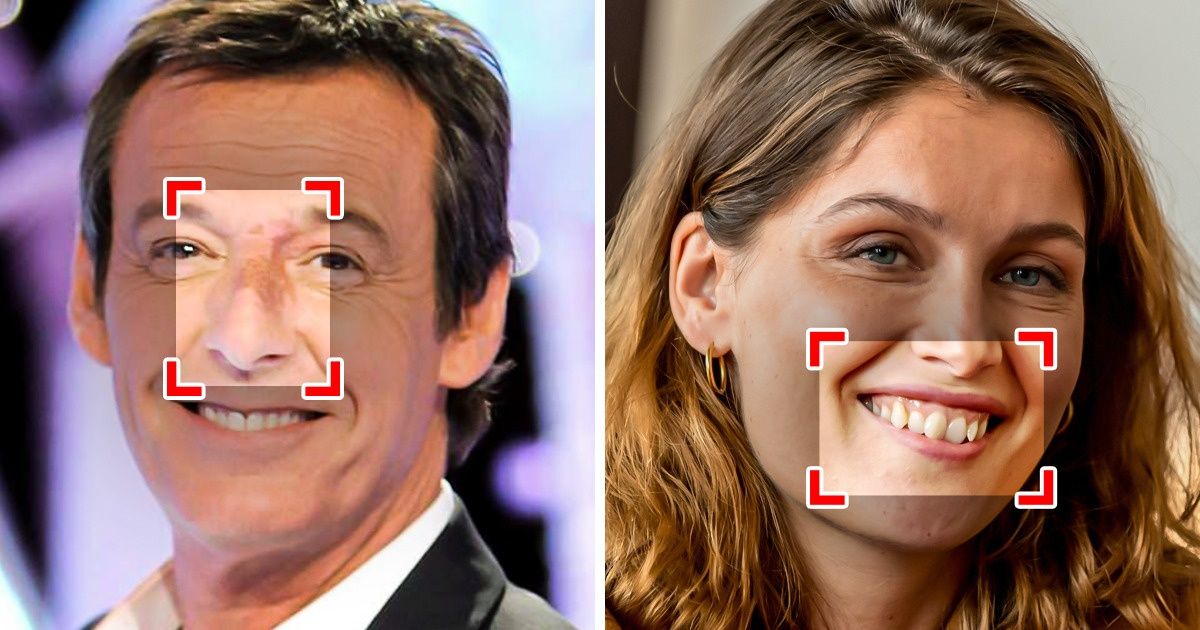 10 Célébrités dont les imperfections physiques se sont transformées en atouts