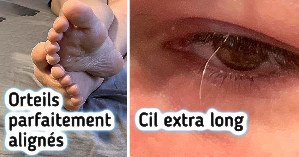 16 Photos de personnes dont le corps est un véritable coffre aux trésors