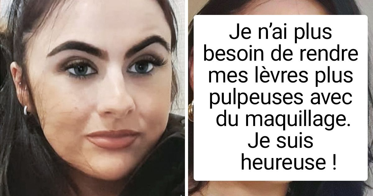 20 Personnes qui ont fait appel à des professionnels pour améliorer leur apparence physique