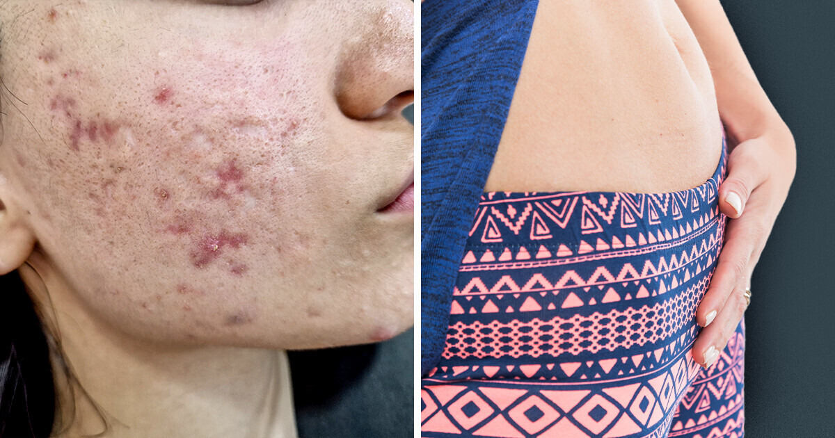 5 Raisons pour lesquelles les épinards sabotent ta santé en secret 5 Raisons pour lesquelles les épinards sabotent ta santé en secret