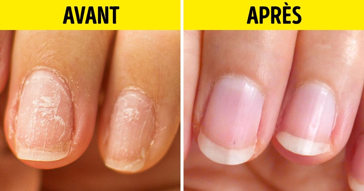 10 Remèdes de grand-mère qui feront des merveilles pour tes ongles 10 Remèdes de grand-mère qui feront des merveilles pour tes ongles