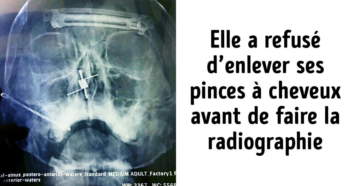 Ces internautes ont partagé les histoires les plus dérangeantes qu’ils ont vécues au travail, et elles te feront pleurer de rire !