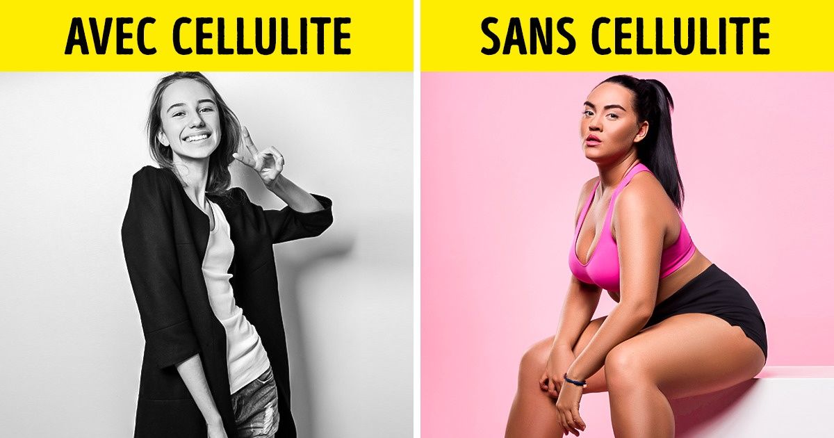 10 Mythes sur la cellulite auxquels beaucoup de gens croient encore 10 Mythes sur la cellulite auxquels beaucoup de gens croient encore