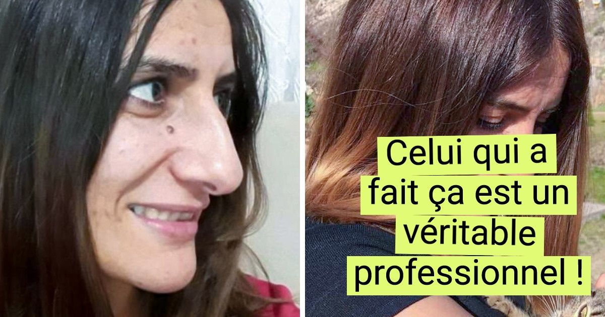 20+ Filles téméraires qui se sont dit : " Arrête de tergiverser, vas-y ! " Et elles ont osé la chirurgie esthétique