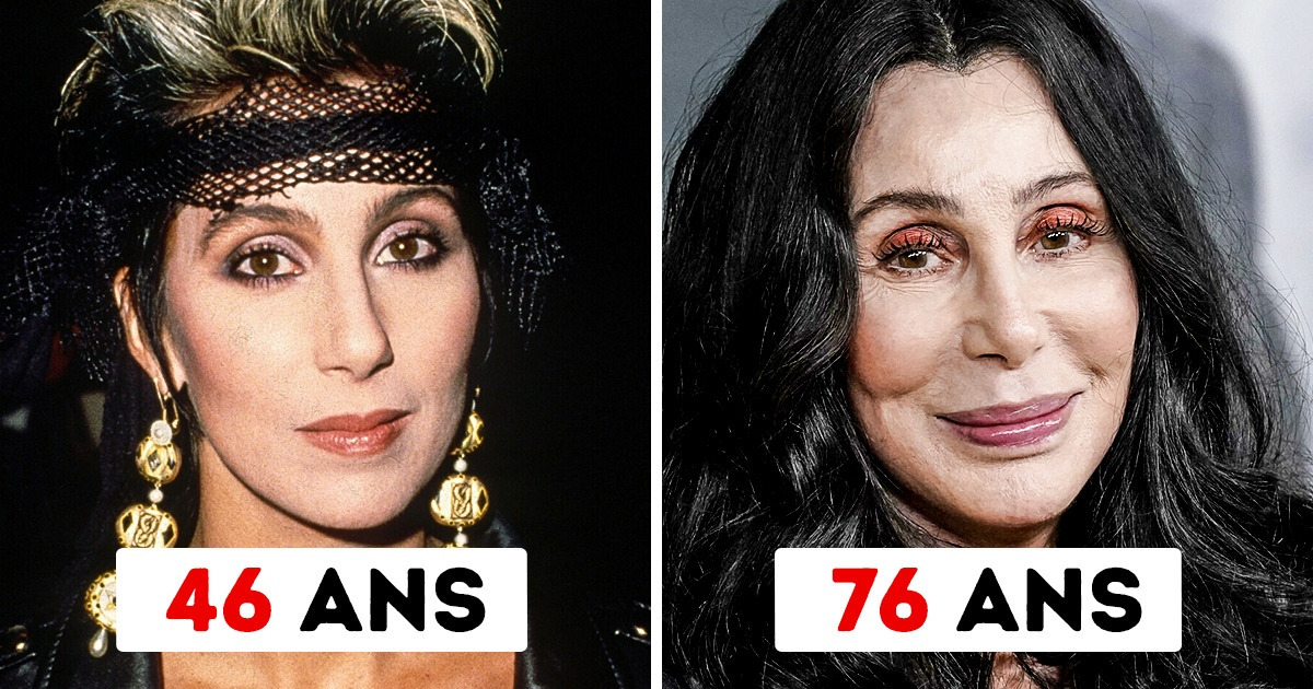 10 Stars qui ne connaissent pas le verbe “vieillir”