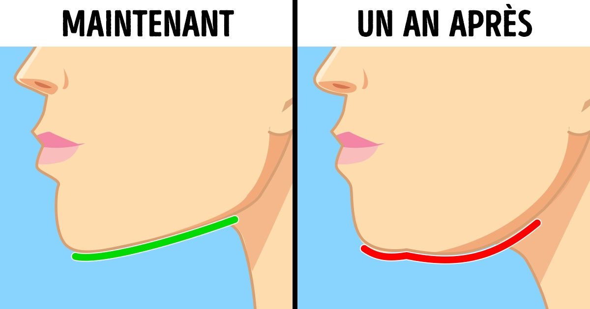 Pourquoi le syndrome du “text-neck” est dangereux et comment éviter les dégâts permanents pour la santé ? Pourquoi le syndrome du “text-neck” est dangereux et comment éviter les dégâts permanents pour la santé ?