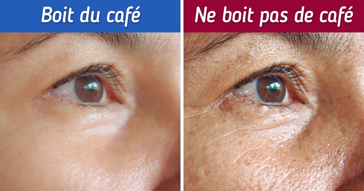 Que va-t-il arriver à ta peau si tu cesses totalement de boire du café Que va-t-il arriver à ta peau si tu cesses totalement de boire du café