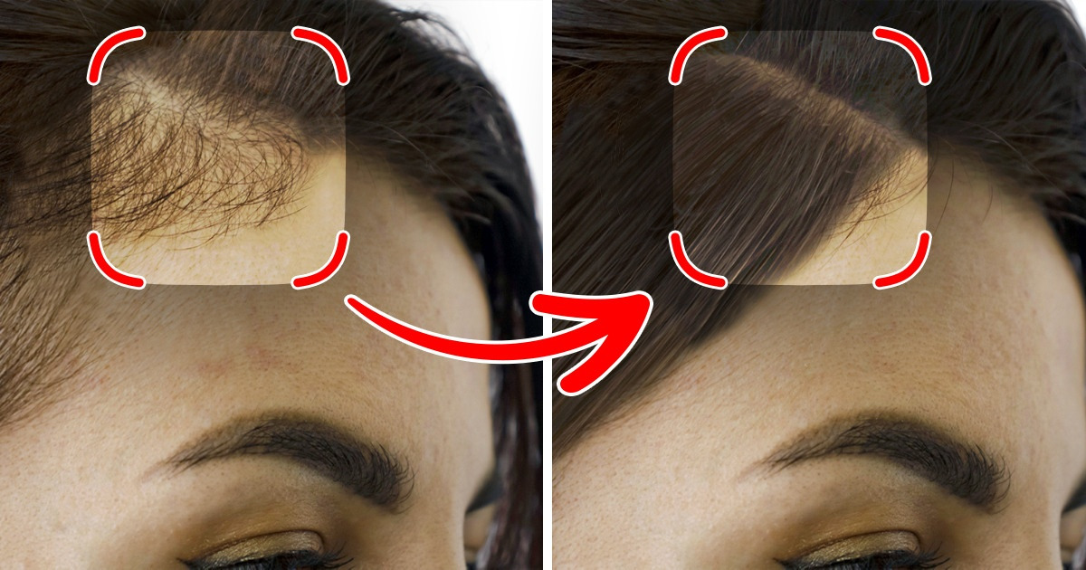Découvre 7 astuces pour renforcer la pousse de tes cheveux