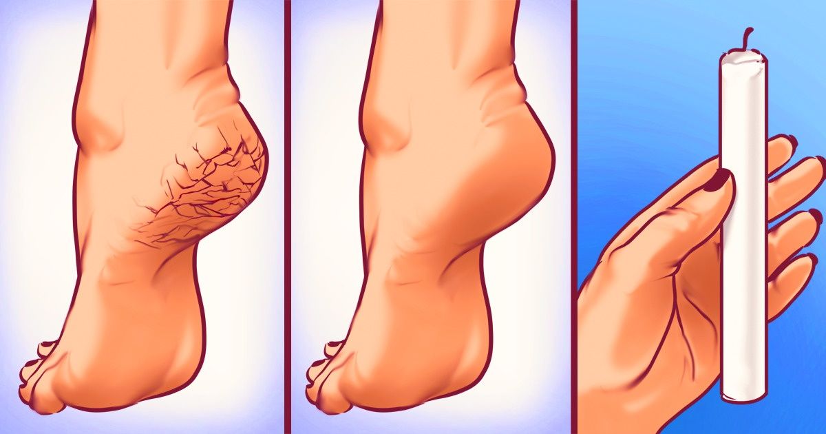 9 manières inhabituelles d’utiliser de la cire ou de la paraffine 9 manières inhabituelles d’utiliser de la cire ou de la paraffine