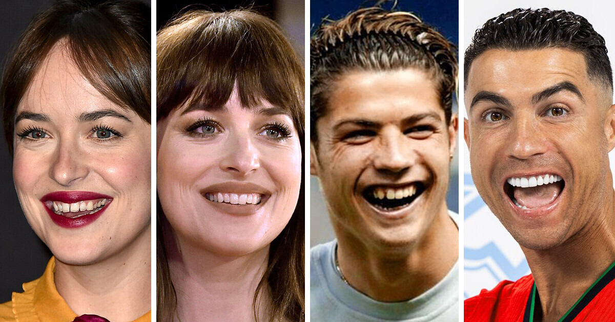 20 Célébrités qui ont changé de sourire comme par magie 20 Célébrités qui ont changé de sourire comme par magie