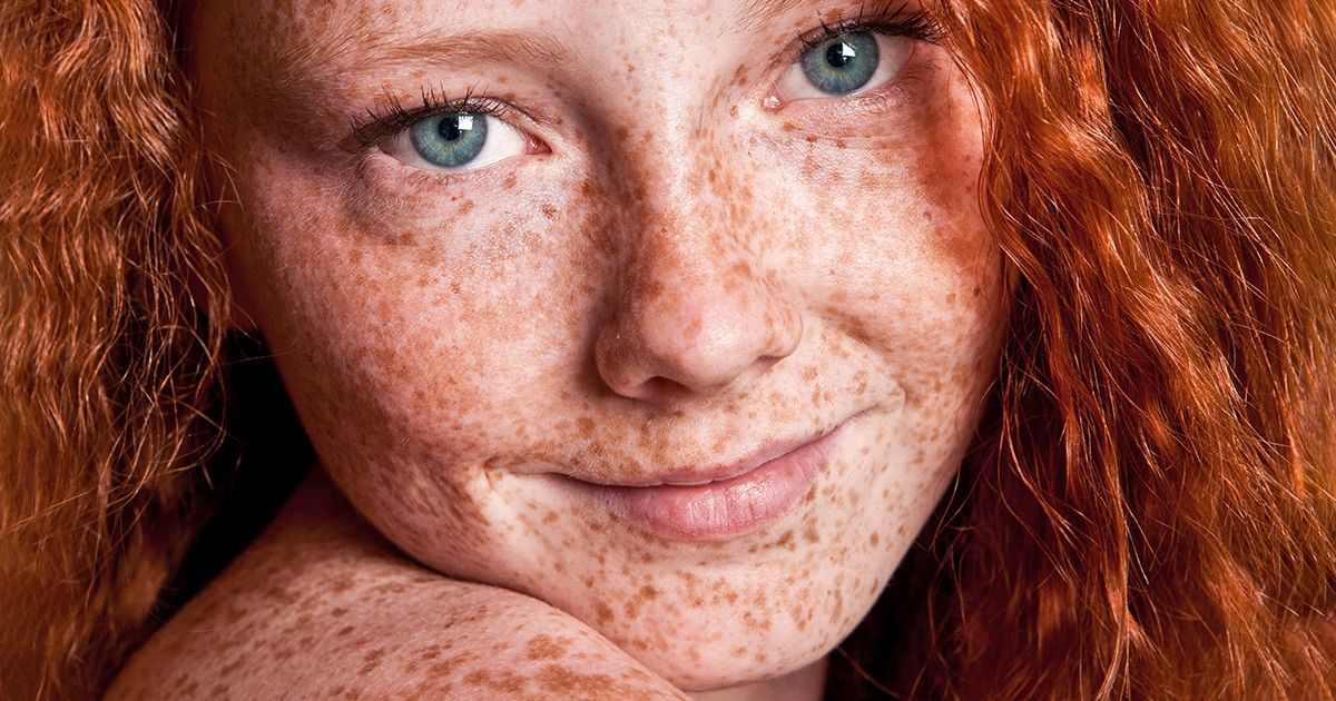 13 Caractéristiques uniques qui rendent les roux si spéciaux