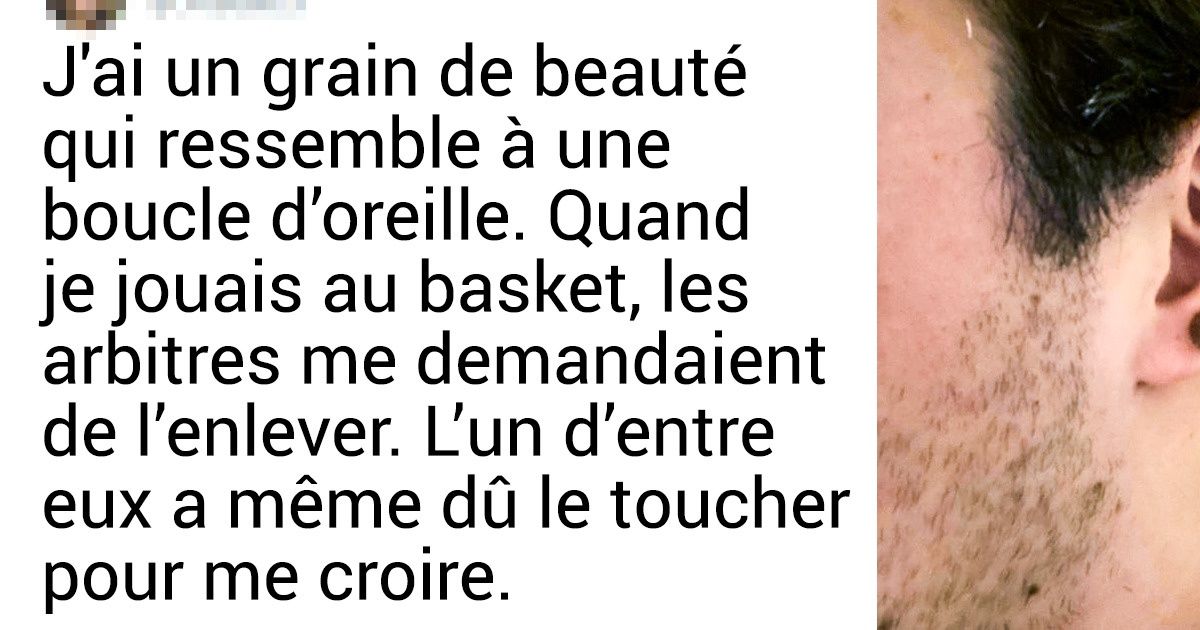 20 Personnes avec une apparence hors du commun qui n’ont pas eu honte de s’exposer au monde entier 20 Personnes avec une apparence hors du commun qui n’ont pas eu honte de s’exposer au monde entier