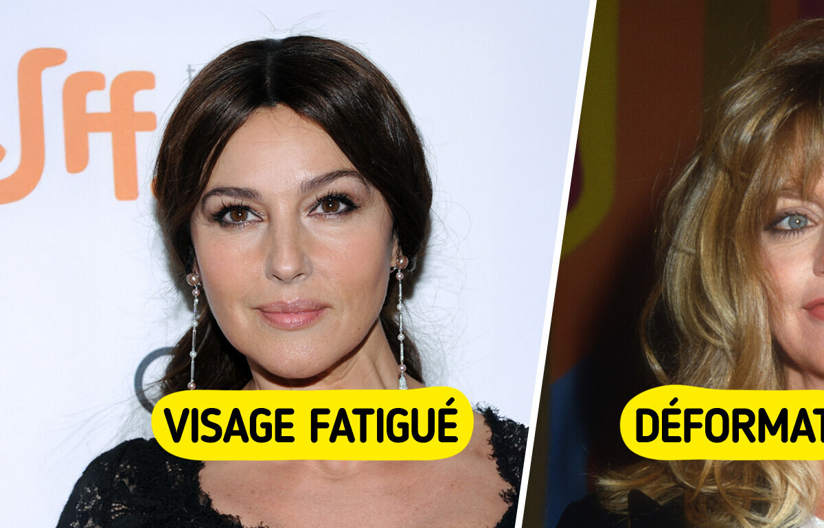 4 Types de vieillissement de la peau, et comment adapter ta routine de soins 4 Types de vieillissement de la peau, et comment adapter ta routine de soins