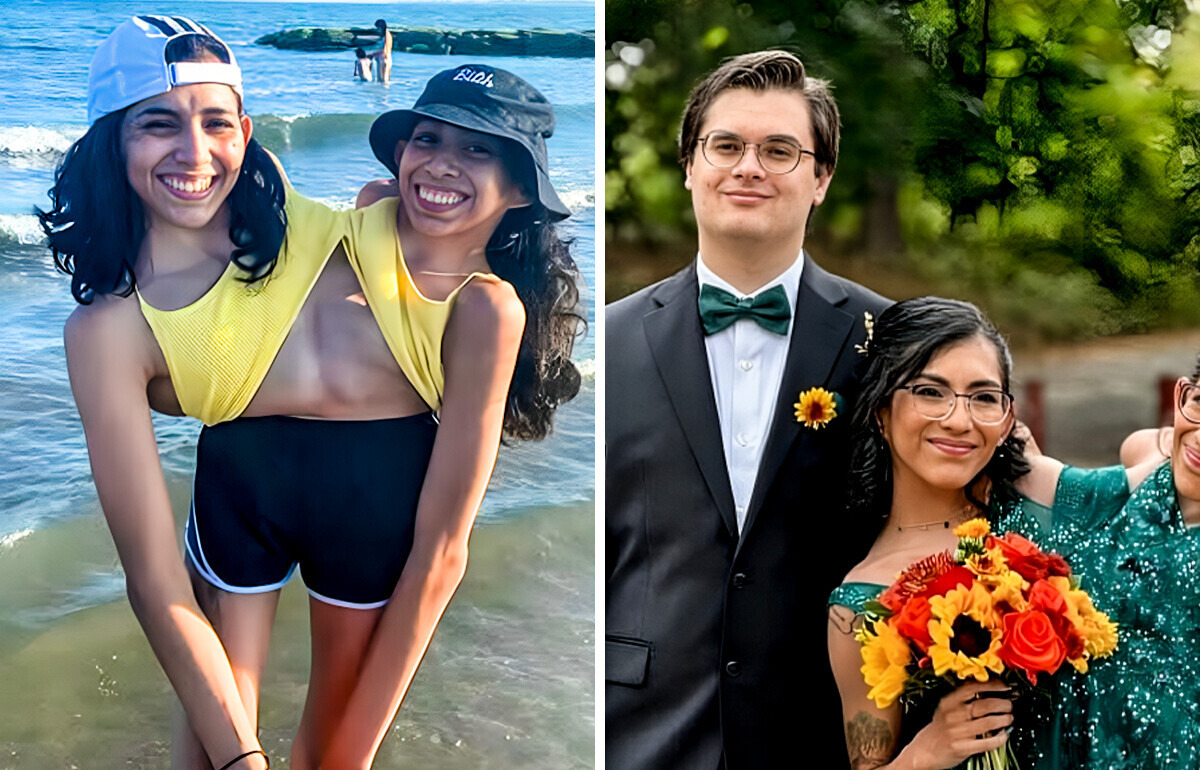 Une des jumelles siamoises dit “oui”, et les internautes se posent tous la même question Une des jumelles siamoises dit “oui”, et les internautes se posent tous la même question